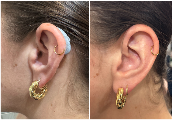 Lexie B3 comparison
